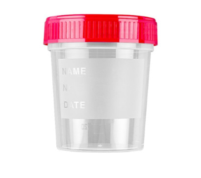 Urinbecher mit Schraubdecke, steril